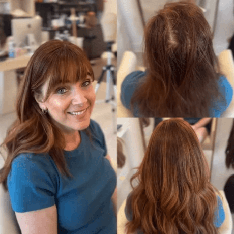 The Ultimate Guide to Choosing a Luxury Hair Topper: Confidence, Comfort, and Style Combined